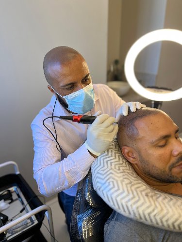 micropigmentação capilar 